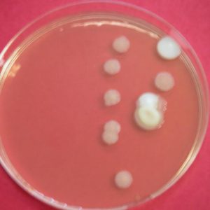 Growth on Petri dishes - France Organo Chimique